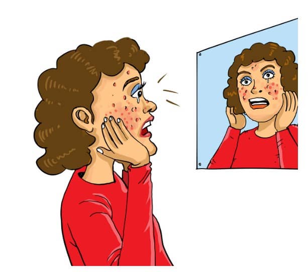 평편사마귀 제거 후 주의해야 할 생활 습관