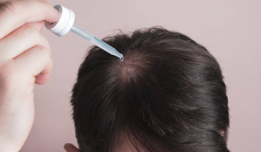 탈모 예방