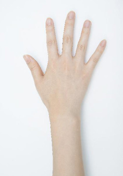 손목터널증후군 증상