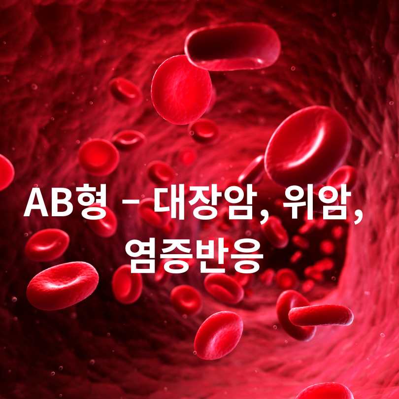 혈액형 따라 잘 생기는 암 종류