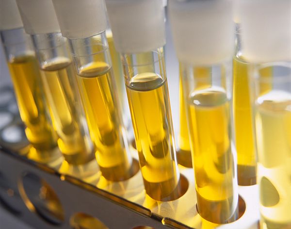 오줌 색깔과 병