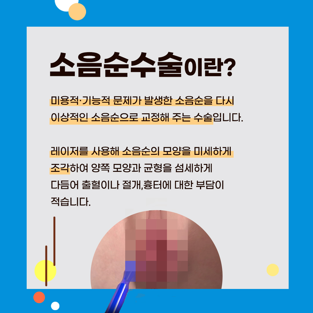 청담산부인과 소음순통증 소음순부음 
소음순수술