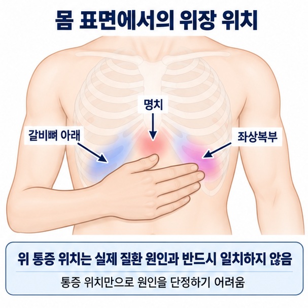 명치 통증, 왼쪽 상복부 불편감, 속쓰림과 함께 위장 위치를 설명하고 병원에 가야 할 증상을 정리한 이미지