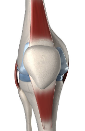 내측 반월상 연골 손상