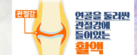 보스웰리아 효능