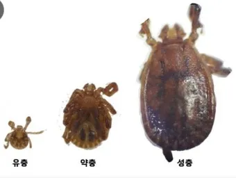 진드기 물린자국 대처법 참진드기 빨간 진드기 증상 확인_15