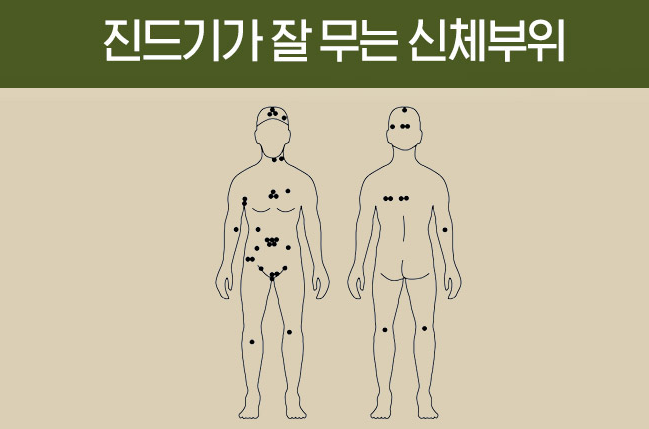 진드기가 잘 무는 신체부위