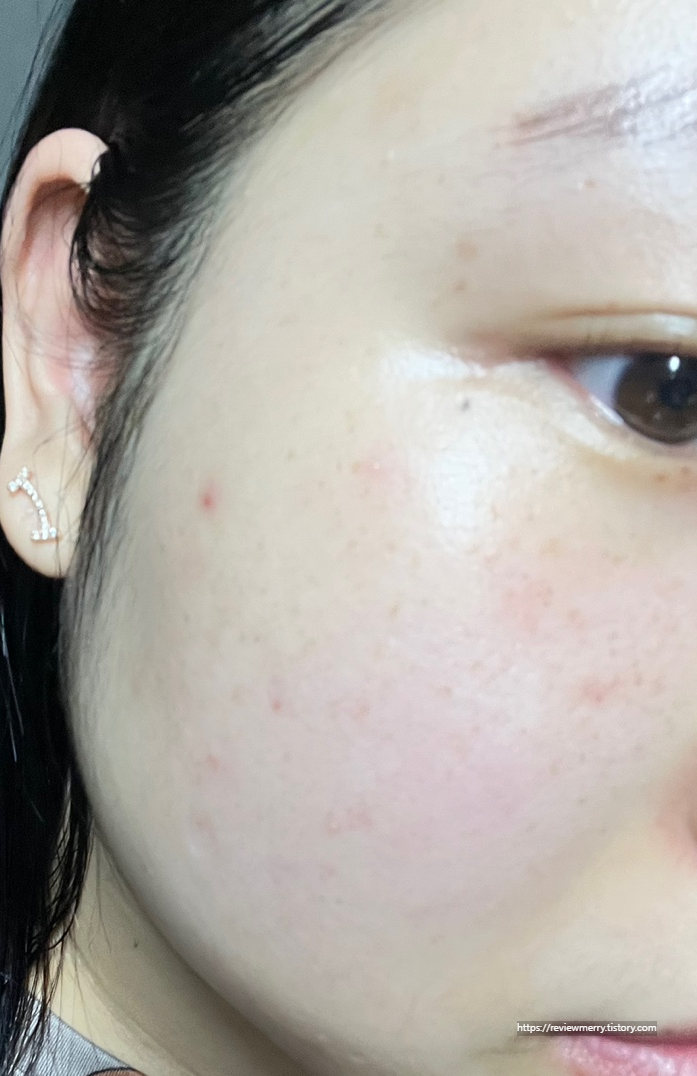 쌩얼 좌측 볼사진