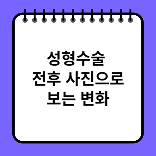 성형수술 전후 사진으로 보는 변화