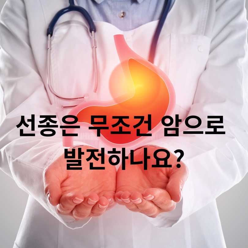 선종과 용종의 차이