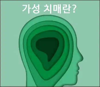 가성 치매란
