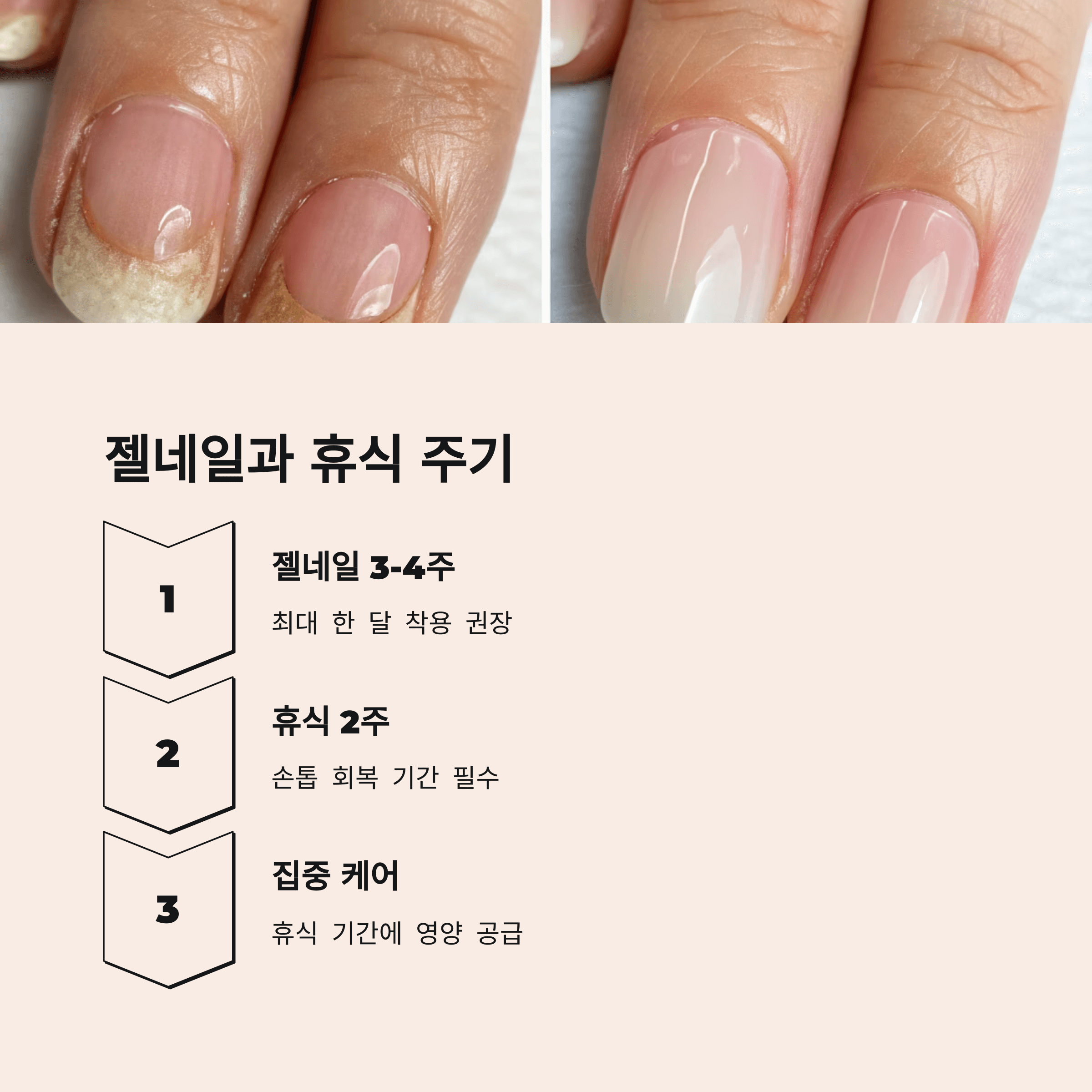 40대 이상을 위한 손발톱 건강관리