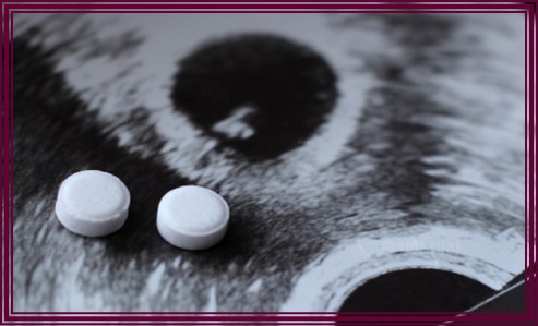 임신 중절 수술 시기