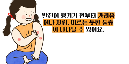 대상포진 초기증상