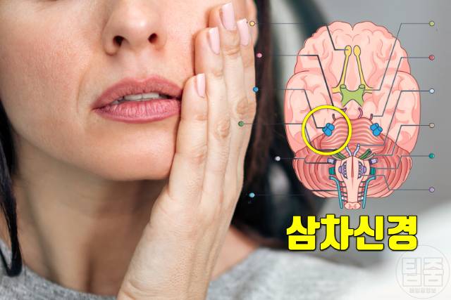 비인두암 증상 얼굴통증 비염 증상