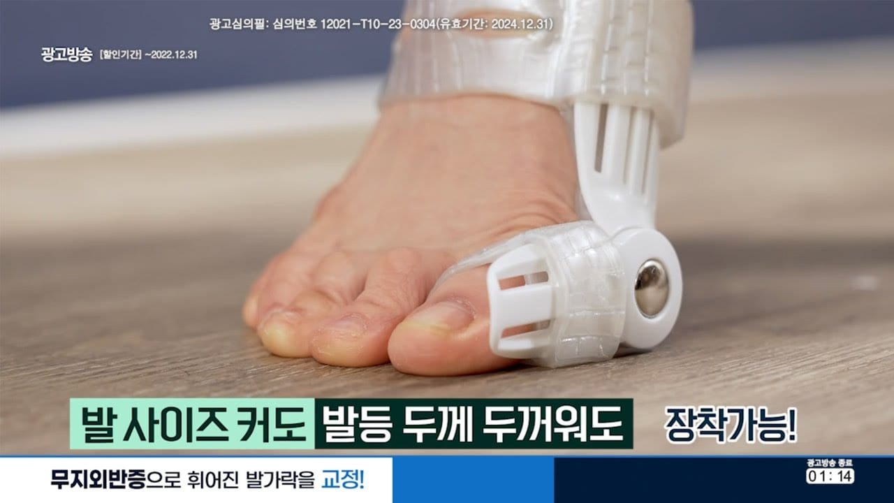 무지외반증 교정기 착용법 사용법