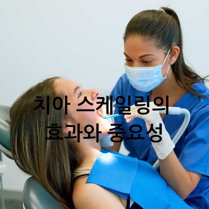 치아 스케일링의 효과와 중요성