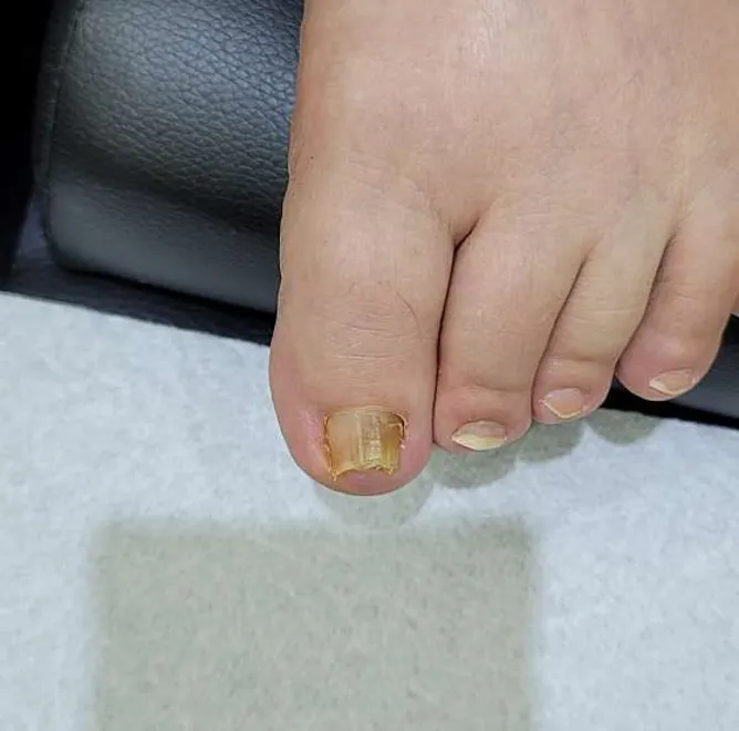 네일이블링블링