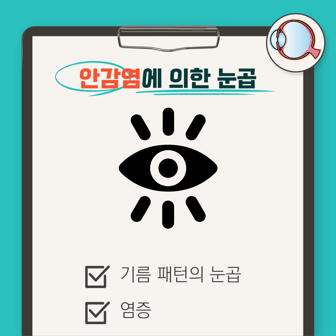 눈곱 끼는 이유: 눈곱 자주 끼는 이유