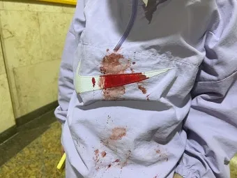 옷에 묻은 실리콘 제거 방법 완벽 가이드 생활 꿀팁_13