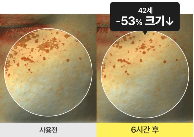 매스티나 화이트 매스틱 앰플