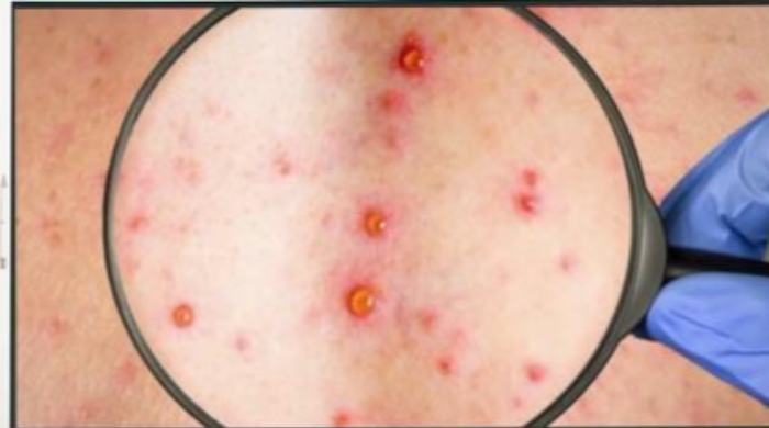 반점이 올라고는 것이 특징