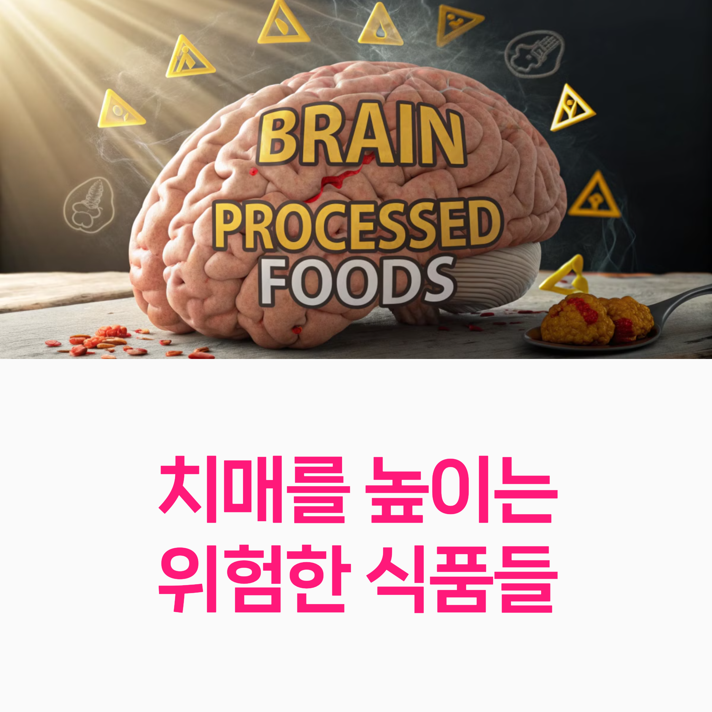 치매예방
