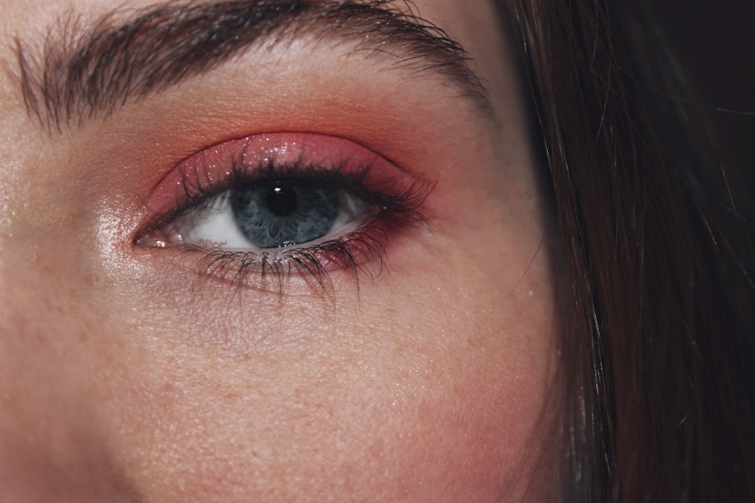 Allergy