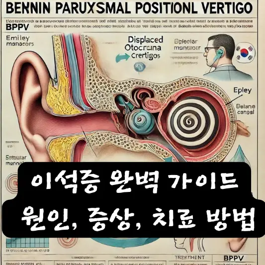 이석증 완벽 가이드 원인, 증상, 치료 방법