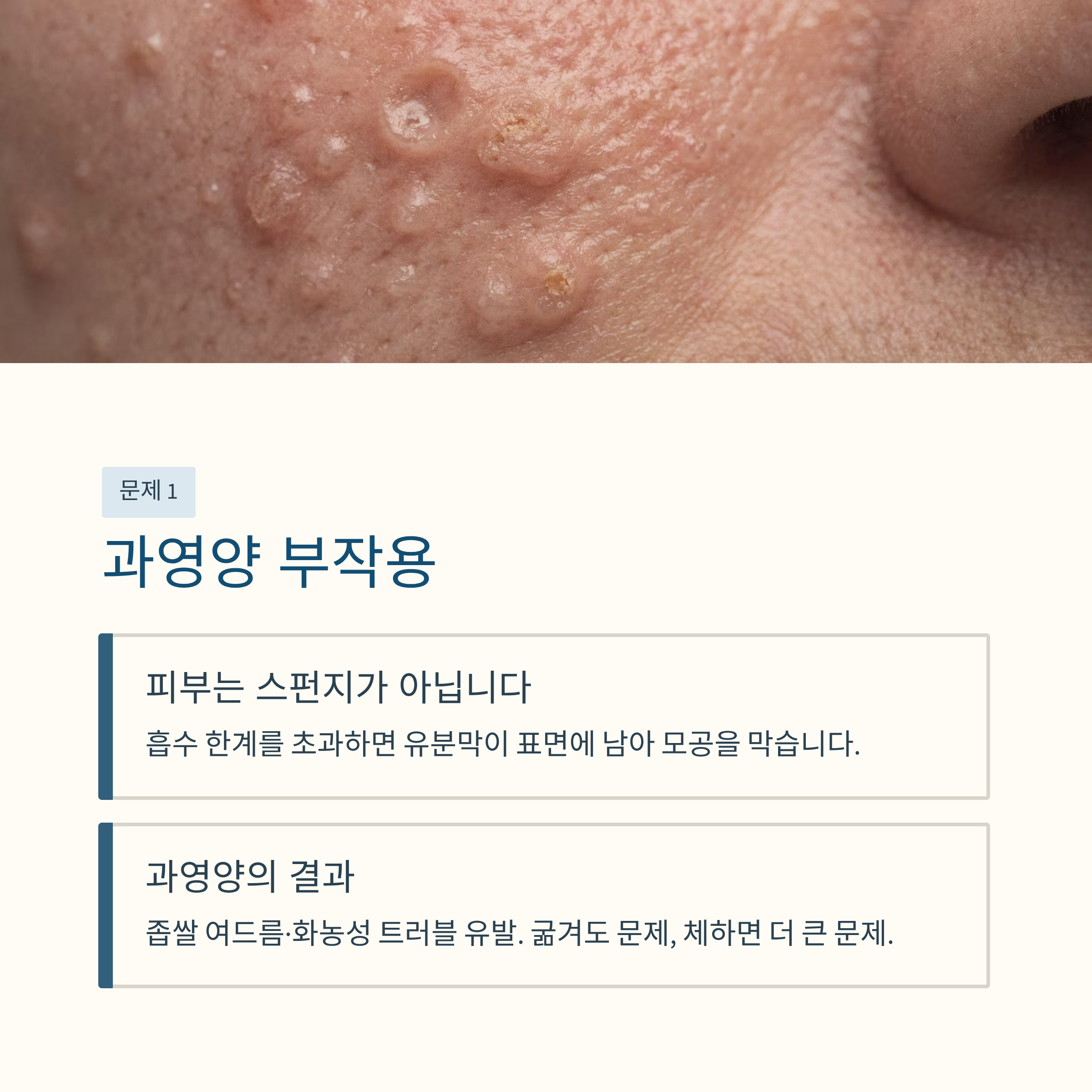 과영양
