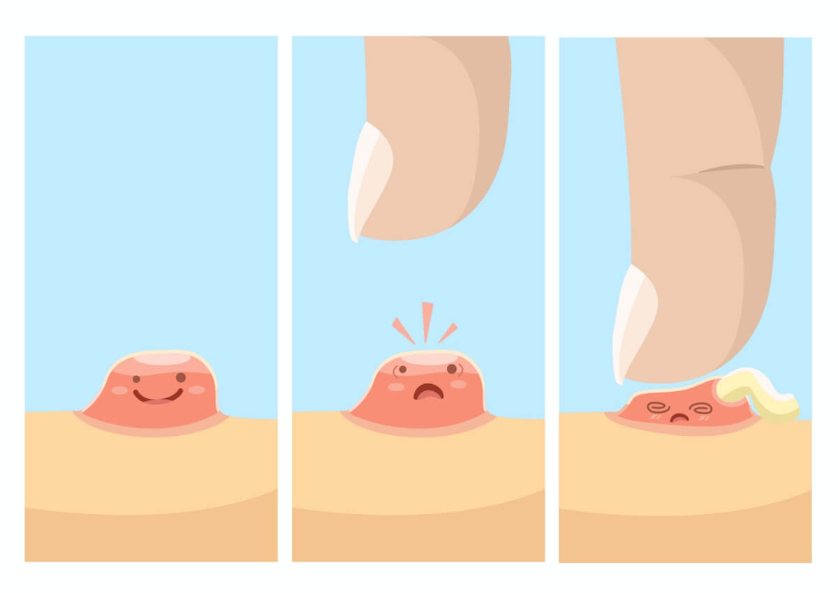 종기를-짜면-나오는-고름