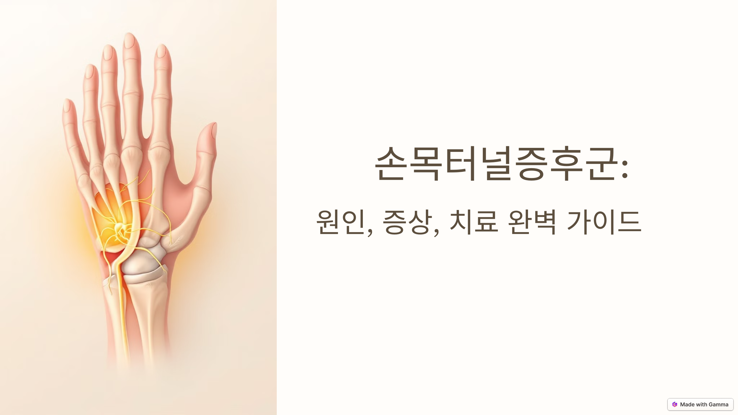 손목터널증후군