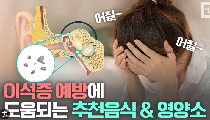 이석증 재발 막는 법