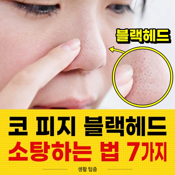 코 피지 제거법, 코 블랙헤드 없애는 방법, 팁줌