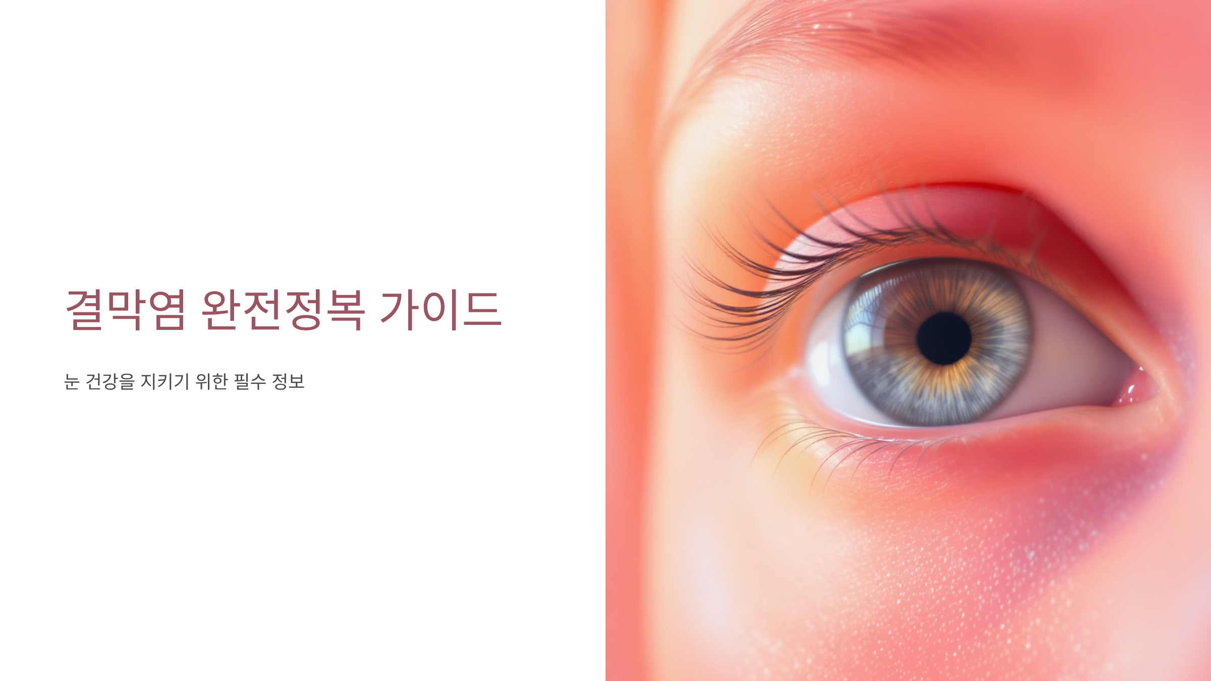 결막염 증상과 치료법 완벽정리