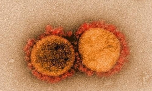 코로나19 변이(BA.2.86) 돌연변이 30개 더 많다