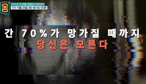 지방간다이어트