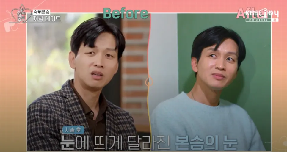 시술 후 달라진 구본승