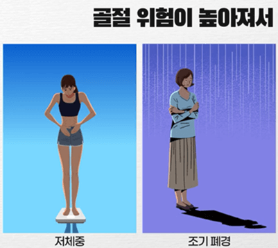 골다공증 검사 비용