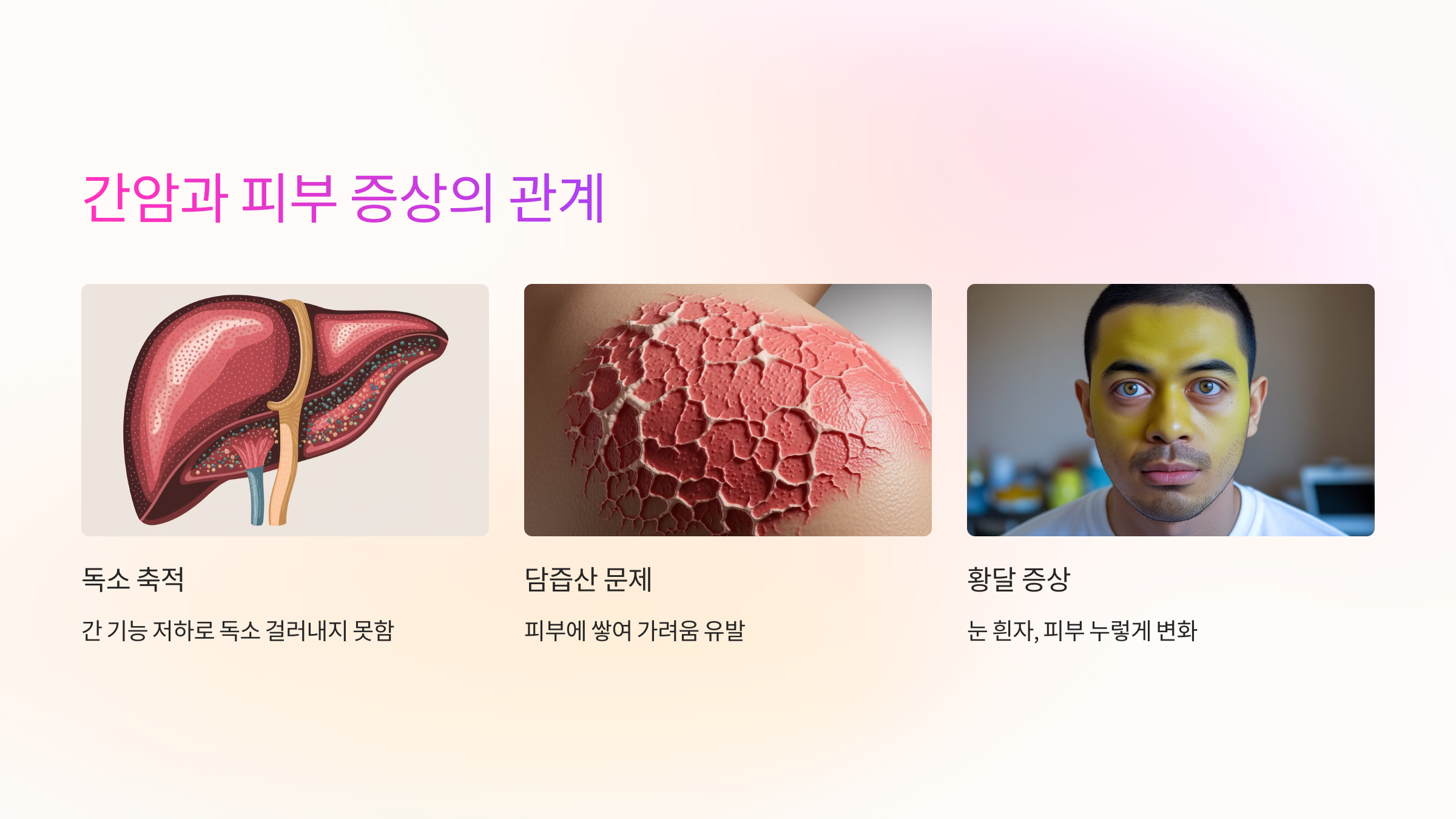 간암과 피부 증상의 관계
