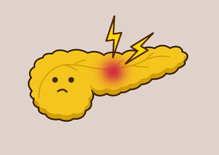 만성-염증이-있는-췌장