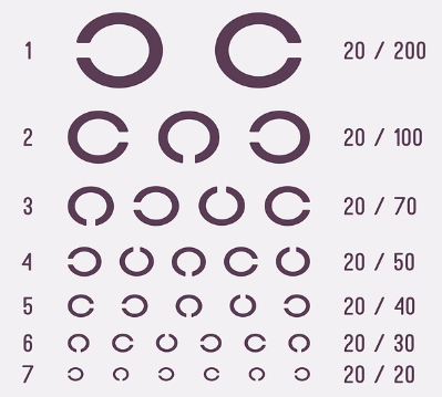 뇌출혈 전조증상 20