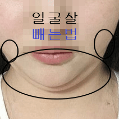얼굴살이 많은 여성의 모습