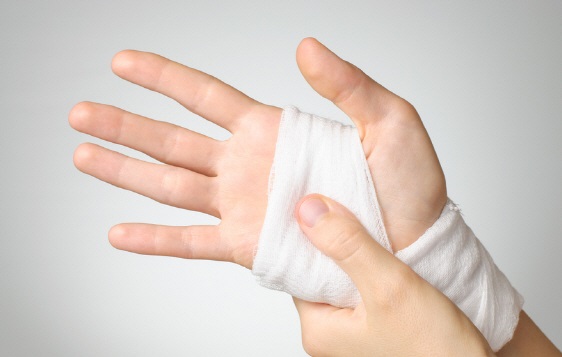 화상을 당했을 때