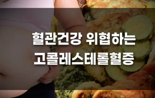 고콜레스테롤 혈증