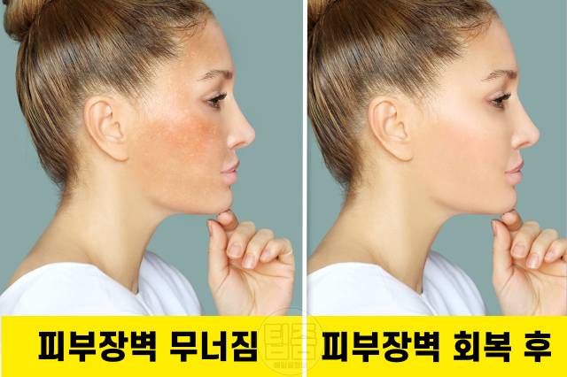 피부장벽 회복 음식 세라마이드 함량 많은 식품