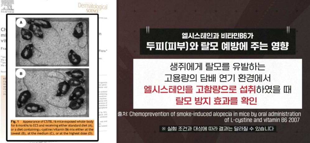 엘시스테인 효능