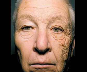 선크림 안바른 트럭운전사