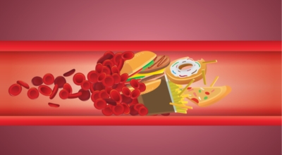 콜레스테롤 이미지