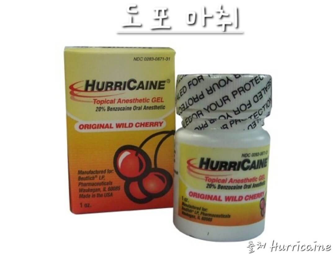 도포마취 허리케인